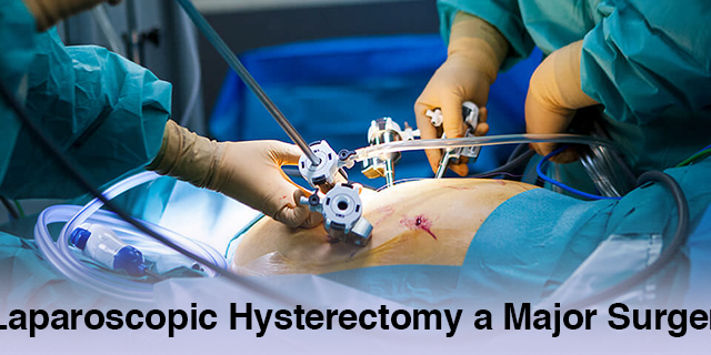 Hysterectomy